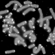 Illustration for article titled Robbing cancer cells of their immortality could stop the disease in its tracks